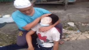 Teks foto : Korban Penganiayaan, Darman Wati Gea