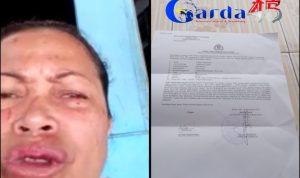 Miris..! Seorang Ibu Rumah Tangga di Rohul Jadi Korban Pengeroyokan, LIRA Riau Desak Polisi Tangkap Pelaku