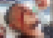 Emosi Soal Rumah Tangga, Pria di Inhu Bacok Teman dengan Parang