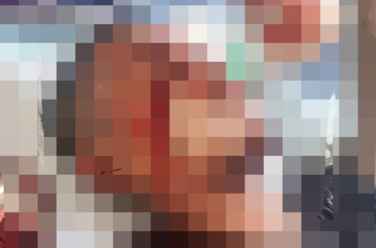 Emosi Soal Rumah Tangga, Pria di Inhu Bacok Teman dengan Parang